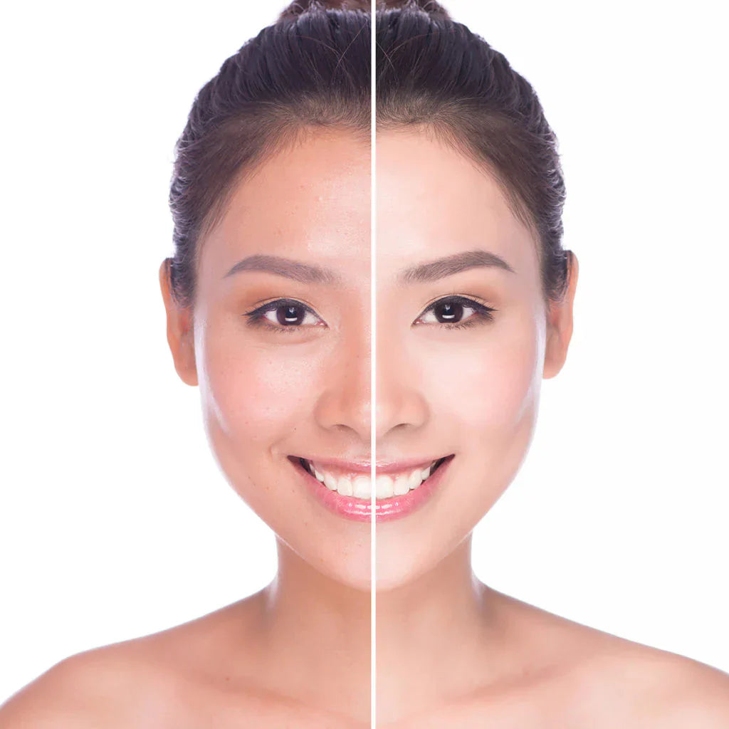 ✨ Glow Up: The Best Korean Brightening Skincare Sets in UAE for Every Skin Type