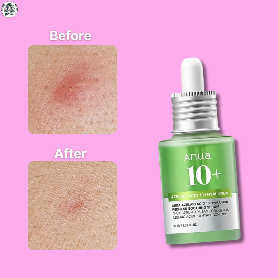 ANUA AZELAIC HYALURON Soothing Serum – 30mL