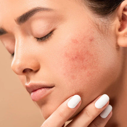 Collection image for: Sensitive Skin
