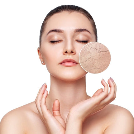 Collection image for: Dry Skin
