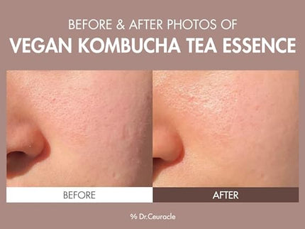 Dr. Ceuracle Vegan Kombucha Tea Essence – 18ml
