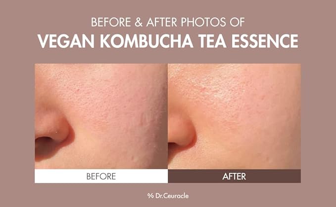 Dr. Ceuracle Vegan Kombucha Tea Essence – 18ml