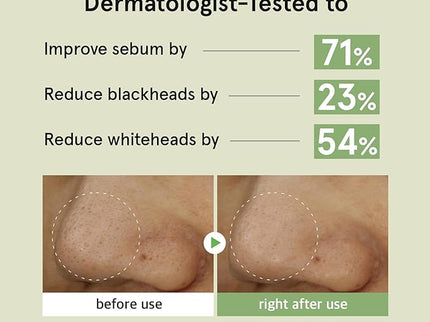 ONE THING Witch Hazel Blackhead Cleaner