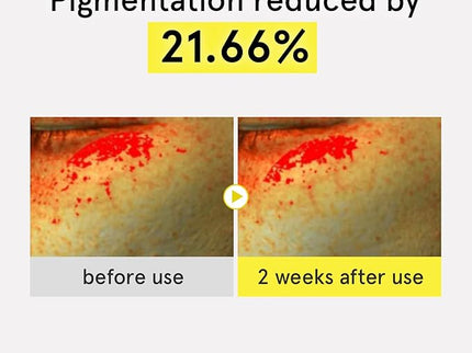 ONE THING Niacinamide Blemish Serum 50g