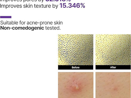 SOMEBYMI Retinol Intense Reactivating Serum 30ml