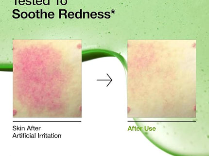 ANUA AZELAIC HYALURON Soothing Serum – 30mL