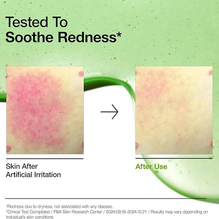 ANUA AZELAIC HYALURON Soothing Serum – 30mL