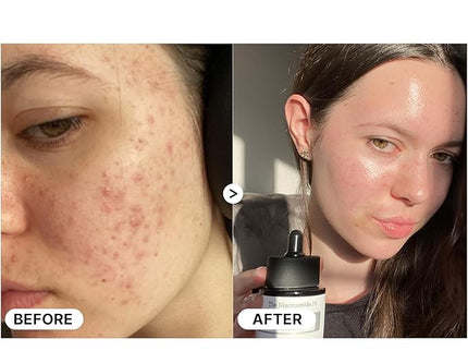 COSRX The Niacinamide 15 Serum