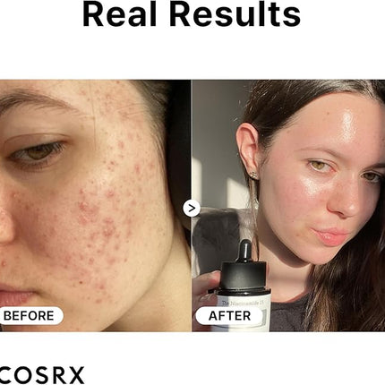 COSRX The Niacinamide 15 Serum