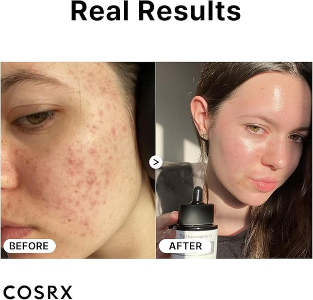 COSRX The Niacinamide 15 Serum