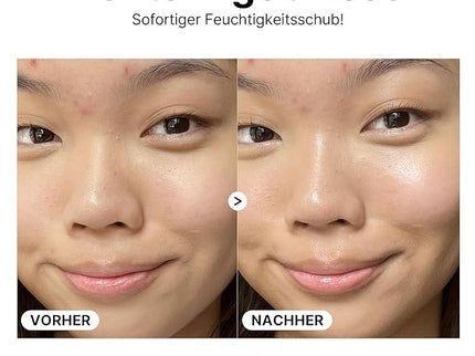 Cosrx The Hyaluronic Acid 3 Serum