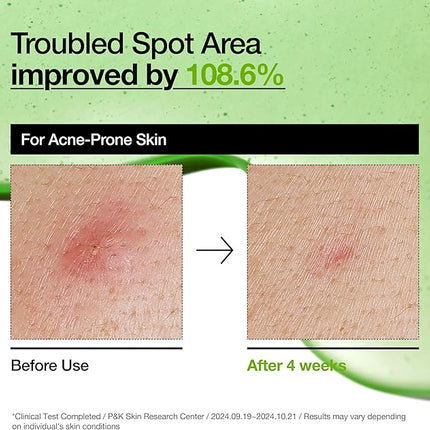 ANUA AZELAIC HYALURON Soothing Serum – 30mL