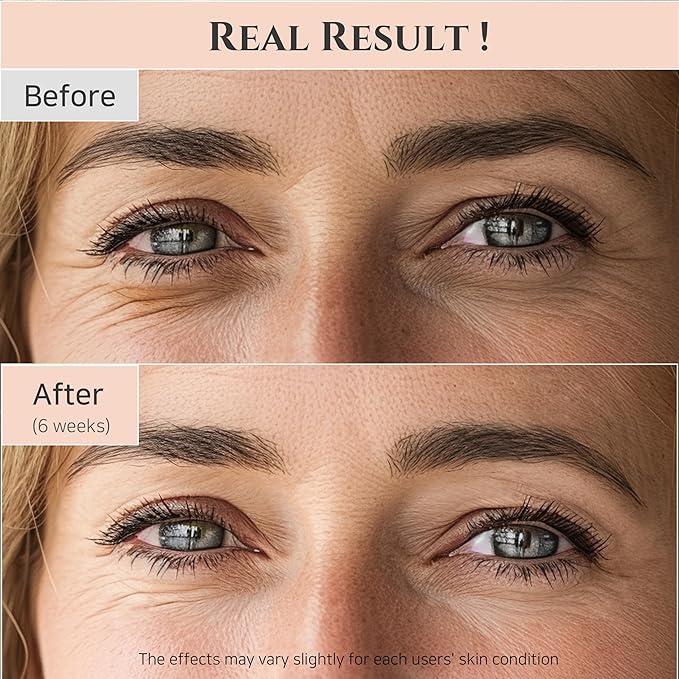 Beauty of Joseon Revive Eye Serum: Ginseng + Retinal 30ml
