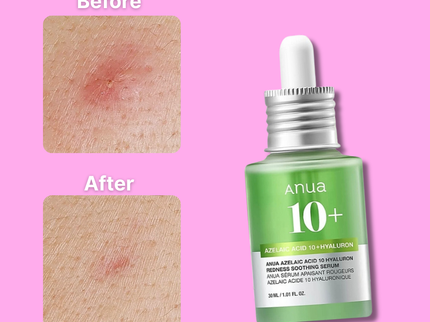ANUA AZELAIC HYALURON Soothing Serum – 30mL