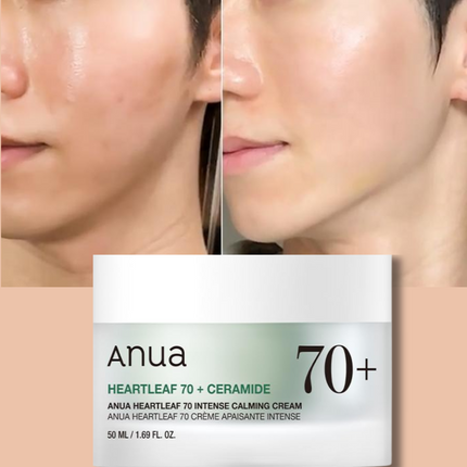 ANUA Heartleaf 70% Intense Calming Cream