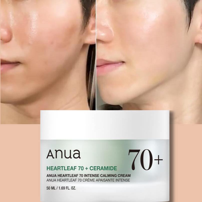 ANUA Heartleaf 70% Intense Calming Cream