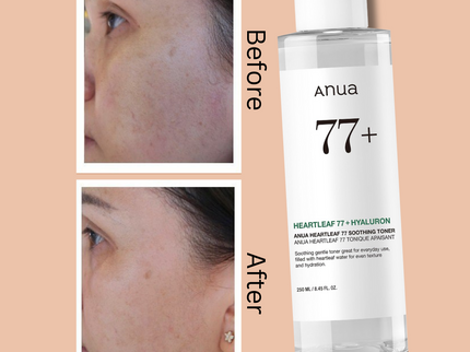 ANUA Heartleaf 77% Soothing Toner I pH 5.5 Trouble Care