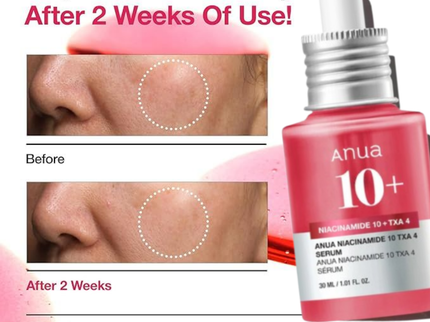 ANUA Niacinamide 10% + TXA 4% Dark Spot Removing Serum – 30mL