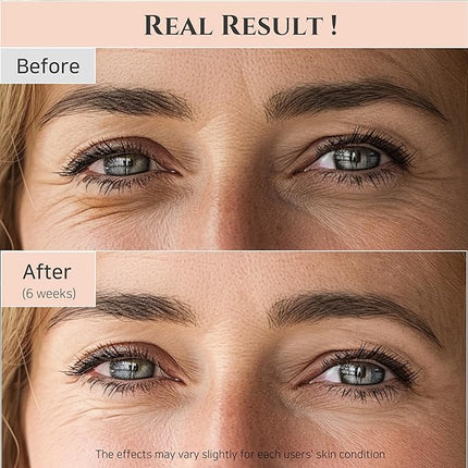 Beauty of Joseon Revive Eye Serum: Ginseng + Retinal 30ml  in uae