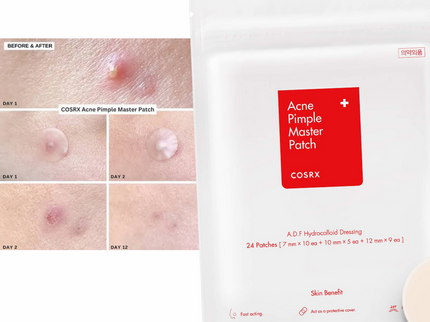 COSRX Acne Pimple Master Patch