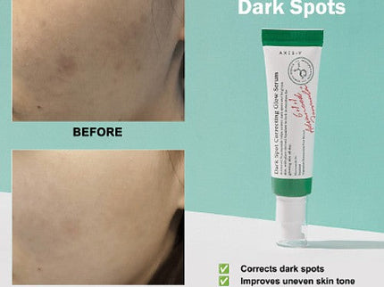 AXIS-Y Dark Spot Correcting Glow Serum