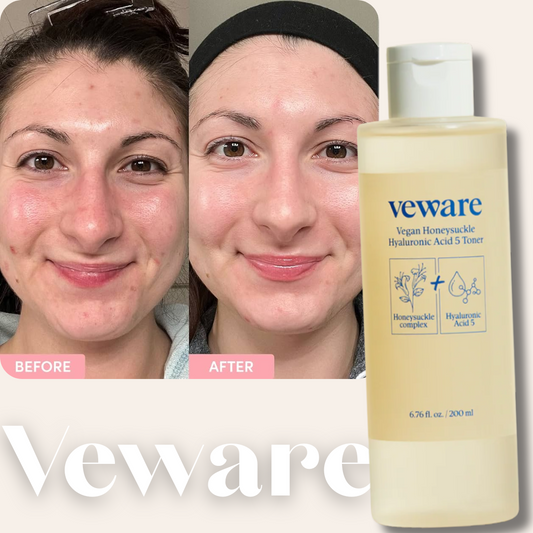 Veware Vegan Honeysuckle Hyaluronic Acid 5 Toner 200 ml