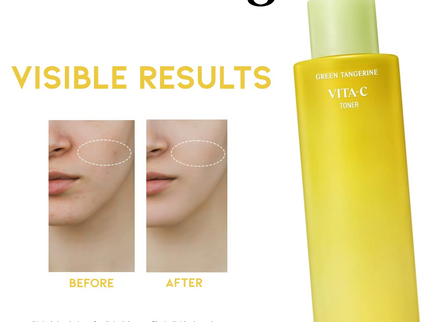GOODAL Green Tangerine Vita C Toner