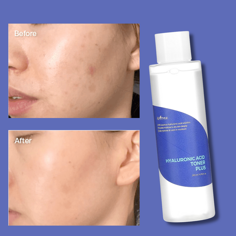 ISNTREE Hyaluronic Acid Toner Plus - 200 ml