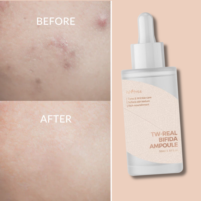 ISNTREE TW-Real Bifida Ampoule 50ml