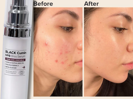 IZEZE BLACK Cumin NPB Bliss Serum
