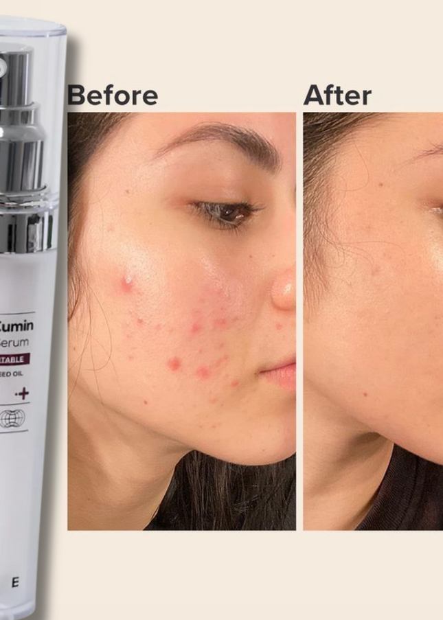 IZEZE BLACK Cumin NPB Bliss Serum