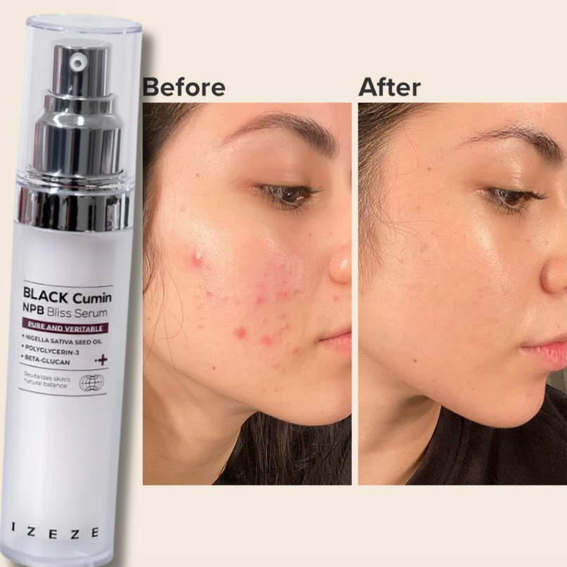 IZEZE BLACK Cumin NPB Bliss Serum