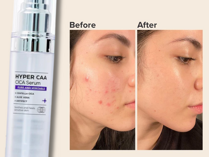 IZEZE HYPER CAA CICA Serum