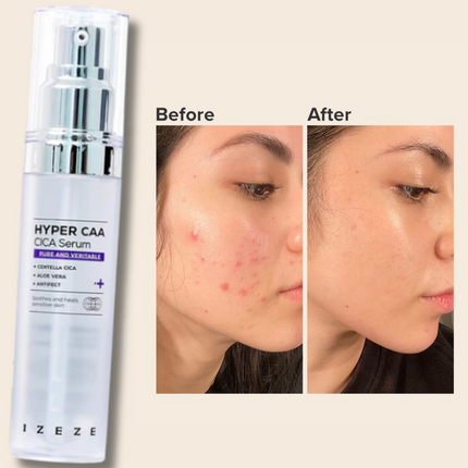 IZEZE HYPER CAA CICA Serum