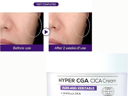 IZEZE HYPER CGA CICA Cream