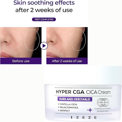 IZEZE HYPER CGA CICA Cream