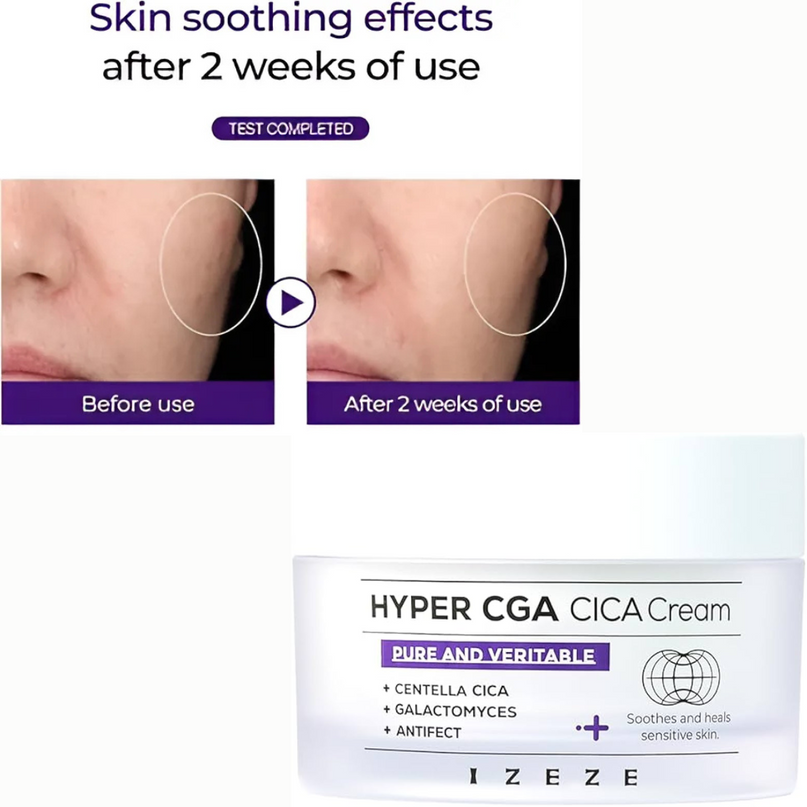 IZEZE HYPER CGA CICA Cream