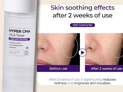 IZEZE HYPER CMA CICA Toner