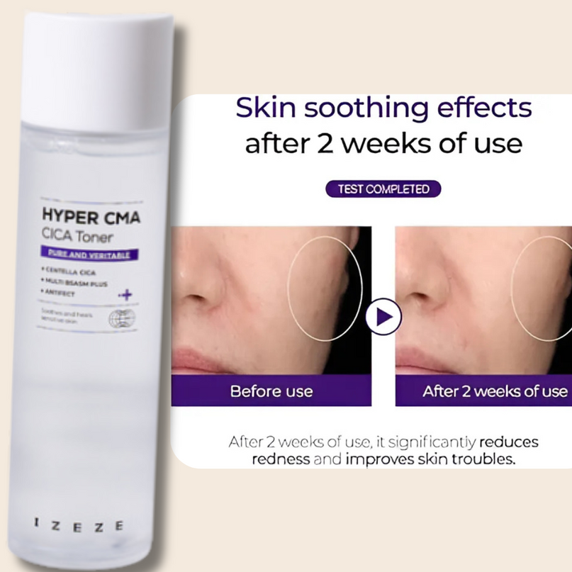 IZEZE HYPER CMA CICA Toner