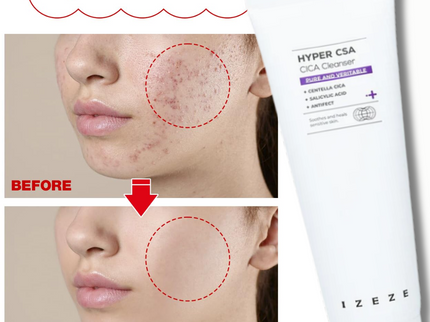 IZEZE HYPER CSA CICA Cleanser
