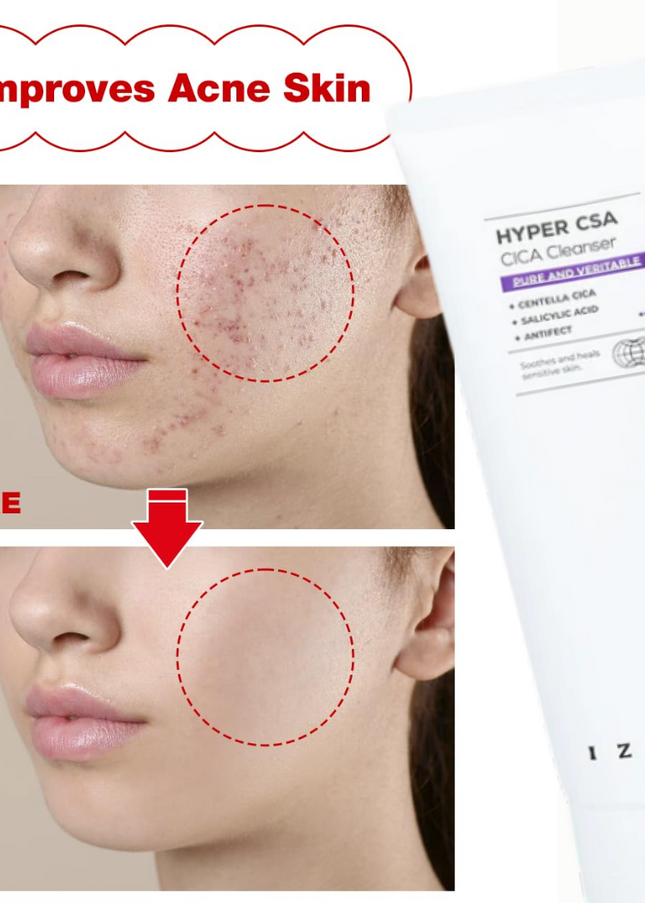 IZEZE HYPER CSA CICA Cleanser