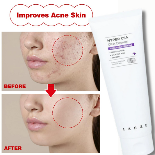 IZEZE HYPER CSA CICA Cleanser