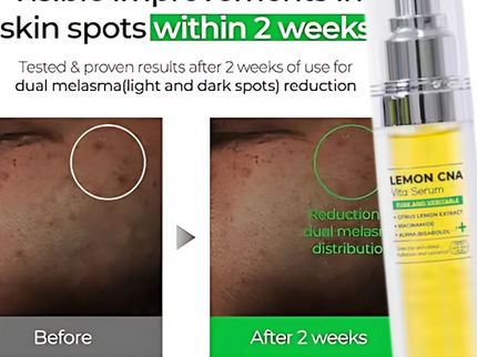 IZEZE LEMON CNA Vita Serum