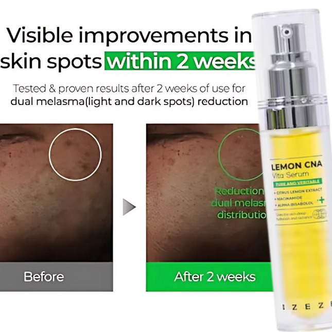 IZEZE LEMON CNA Vita Serum