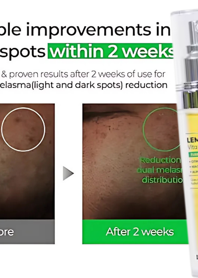 IZEZE LEMON CNA Vita Serum