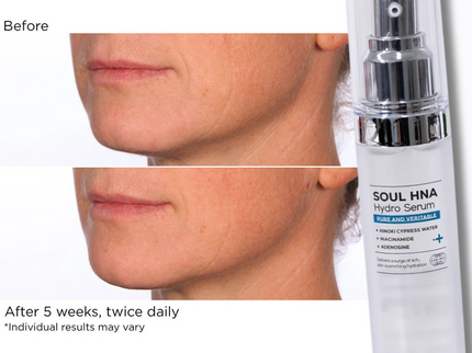 IZEZE SOUL HNA Hydro Serum