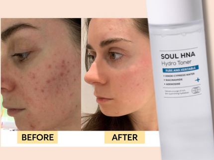 IZEZE SOUL HNA Hydro Toner