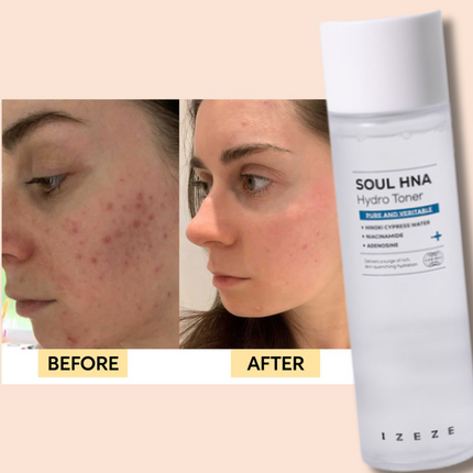 IZEZE SOUL HNA Hydro Toner
