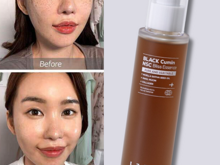 IZEZE Black Cumin NSC Bliss Essence – 30mL