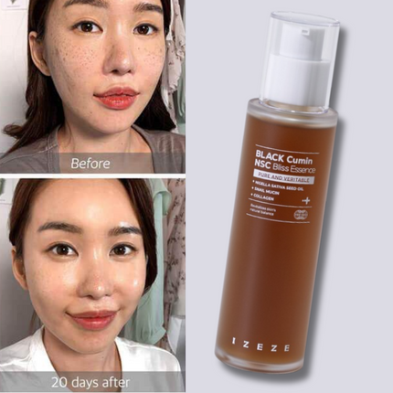 IZEZE Black Cumin NSC Bliss Essence – 30mL